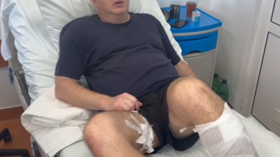 Mărturia emoționantă a tatălui atacat de o haită de câini: ”Am fost aruncat jos, mi-am protejat fetița”